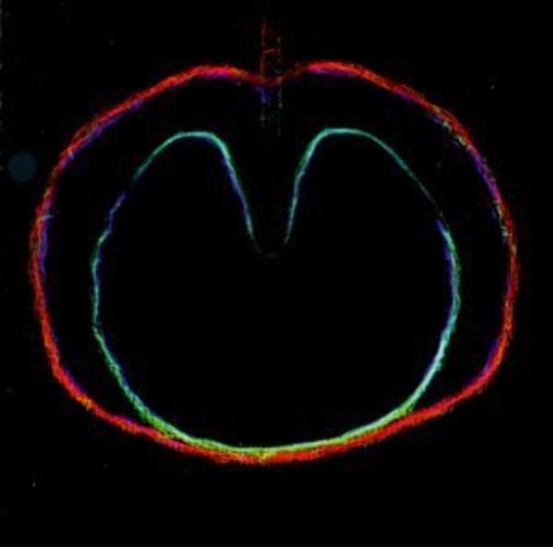 XTC: Wasp Star (Apple Venus Vol. II)